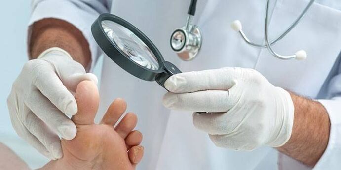 The doctor examines a patient's foot with a nail with a magnifying glass